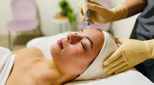 What is Rejuvenation Skin Needling? Debunking Myths and explaining the basics.